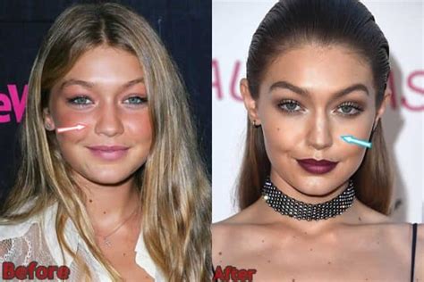 gigi hadid before and after.